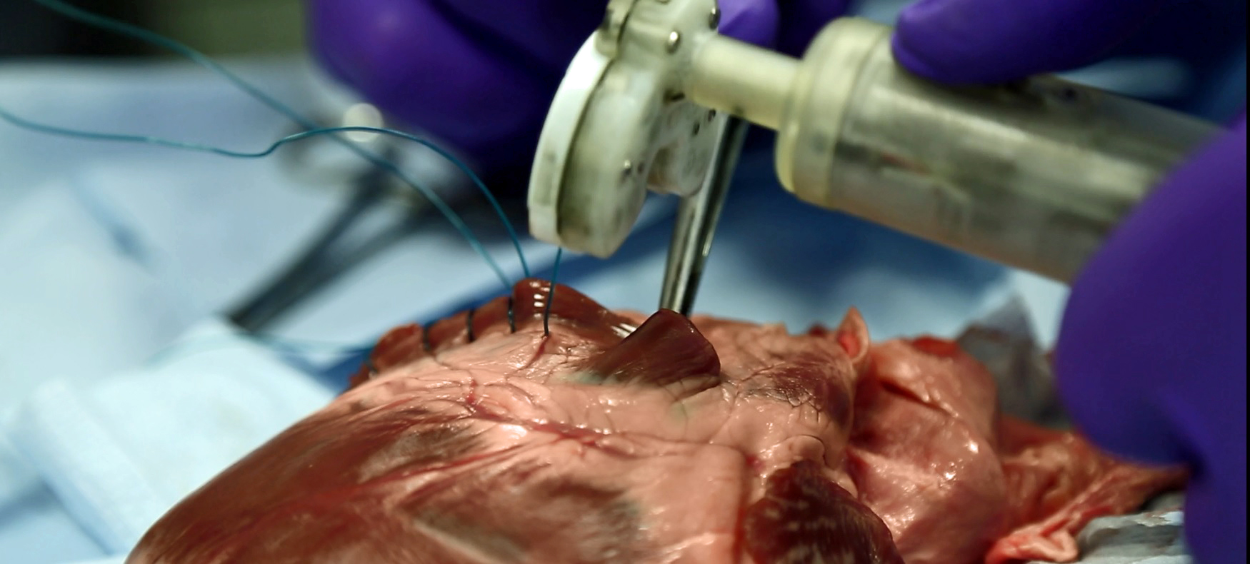 Learning By Heart 3d Printing Could Help Save Lives One Day Ge News