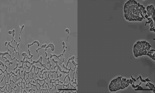/><br />
<br />
<em>Pseudomonas aeruginosa is a bacterial pathogen that is able to <a href=
