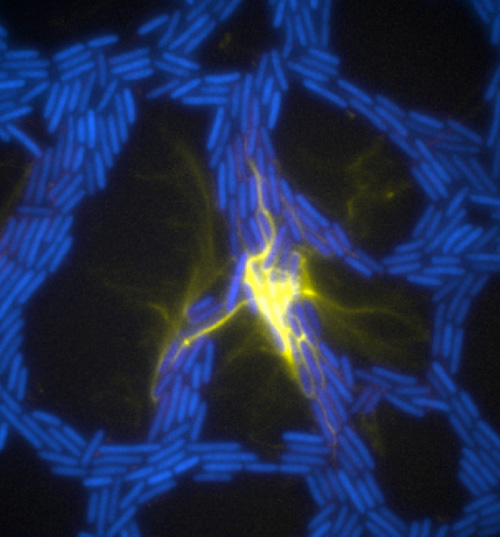 /><br />
<br />
<em> Extracellular DNA (yellow) in biofilms of the bacterial pathogen Pseudomonas aeruginosa organizes traffic flow of individual bacteria (blue) as they move through the biofilm trail network. Credit: E. Gloag and L. Turnbull, The ithree institute, University of Technology Sydney.</em><br />
<br />
This insight could guide scientists to new ways of fighting biofilms. “We could introduce artificial channels along the surface of the device and confuse the bacteria so they can’t be as effective,” Whitchurch says. “Another option would be destroying the eDNA.”<br />
<br />
Scientists have recently used the OMX microscope to observe malaria parasites attacking blood cells, the response of cancer cells to chemotherapy, and even the cell-to-cell transmission of HIV. Jane Stout, a research associate at Indiana University, used it to study cell division and dubbed the machine the “OMG.” Dr. <a href=
