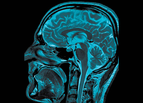 /></div><br />
At least 1.7 million traumatic brain injuries (TBIs) occur in the United States annually. These head traumas contribute to a third of all injury-related deaths, according to the Centers for Disease Control and Prevention.<br />
<br />
In 2013, the National Football League, Under Armour, and GE launched Head Health Challenge, an innovation quest designed to crowdsource new materials and tools to protect the brain and track head injuries in real time. The goal of the project is to speed diagnosis for mild traumatic brain injuries, improve treatment, and increase the safety of athletes, soldiers and the rest of us.