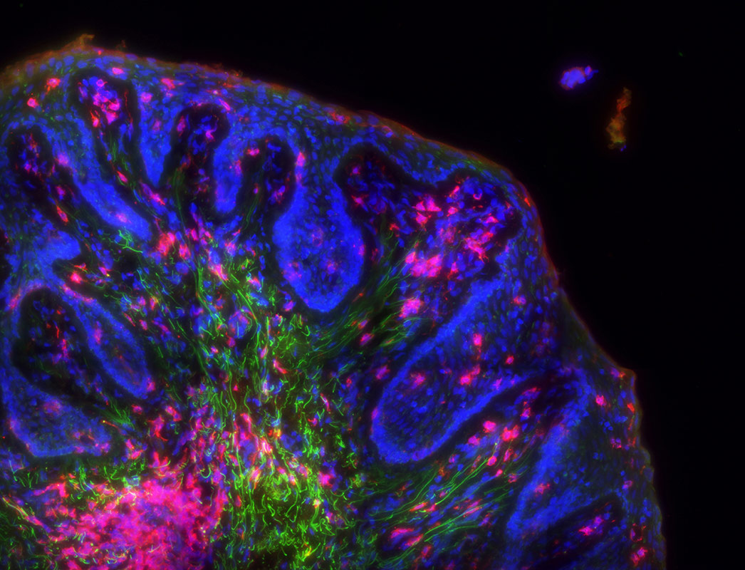 Category: Microscopy. Image description: Tissue section stained for CD4+ cells (red), stroma (green) and nuclei (blue). Therapeutic focus: HIV.