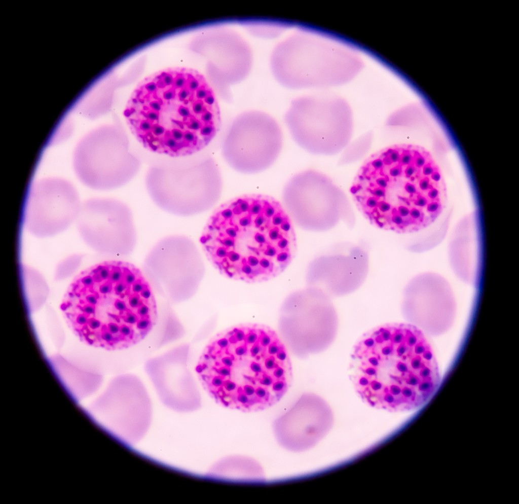 Malaria pigment