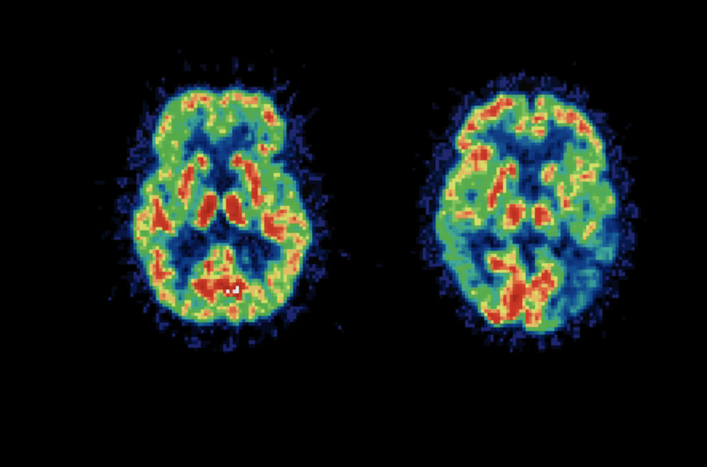 Brain Scan Comparison