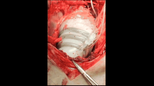 HeartSleeveFinalGif1