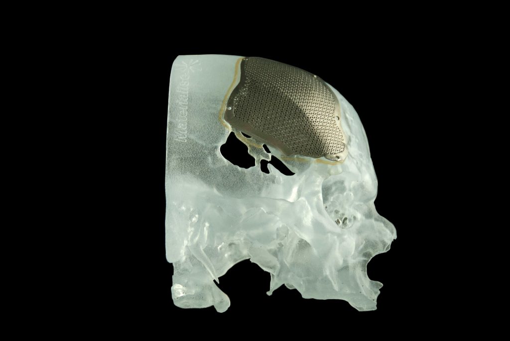  width=