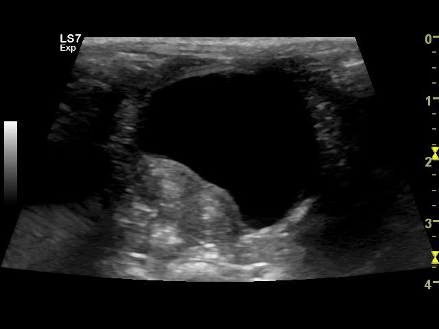  /><br />
<br />
<em>An&nbsp;ultrasound showing a koala's&nbsp;healthy bladder and uterus. Good news,&nbsp;Willow is chlamydia free.&nbsp;</em><br />
<br />
As a result, koalas can live with the disease undetected for long periods of time, causing serious damage. If left untreated, chlamydia can cause blindness, and it can also damage a koala’s ability to have joeys.<br />
<br />
In North Western NSW, the area around the town of Gunnedah is home to the largest population of koalas in the state. It has also become the focal point of a landmark study aimed at saving this threatened species.<br />
<br />
Dr Matthew Crowther, research leader and Senior Lecturer in Biological Sciences at the University of Sydney is working with a team of scientists to uncover some fascinating insights into koala behaviour (<a href=