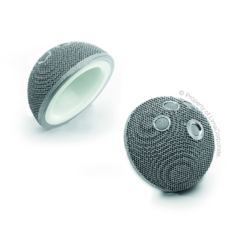 100,000 Patients Later, The 3D-Printed Hip Is A Decade Old And Going