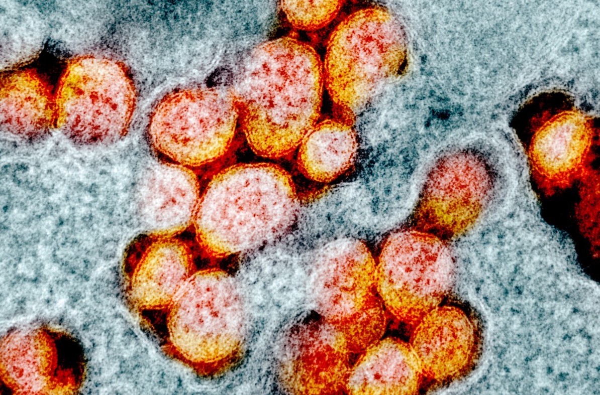 SARS-CoV-2 cell hopping