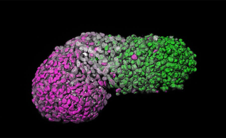 Image analysis of human gastruloid showing âanteroposteriorâ patterning. Green is the posterior part, similar to the tail-end of an embryo; magenta is the anterior part, similar to developing heart cells; grey marks DNA. Caption and image credit: Cambridge University.