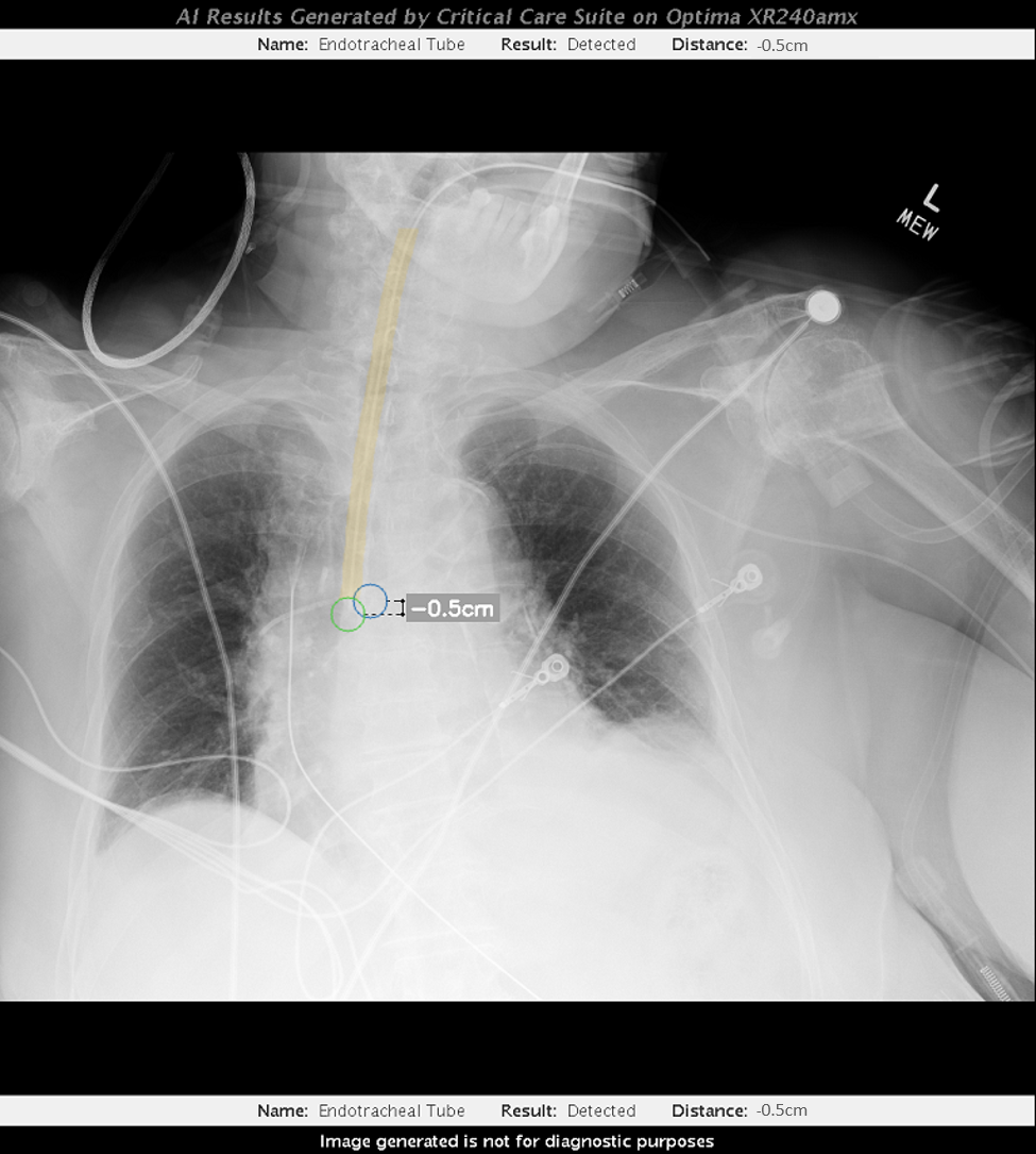 Critical Care Suite GE Healthcare