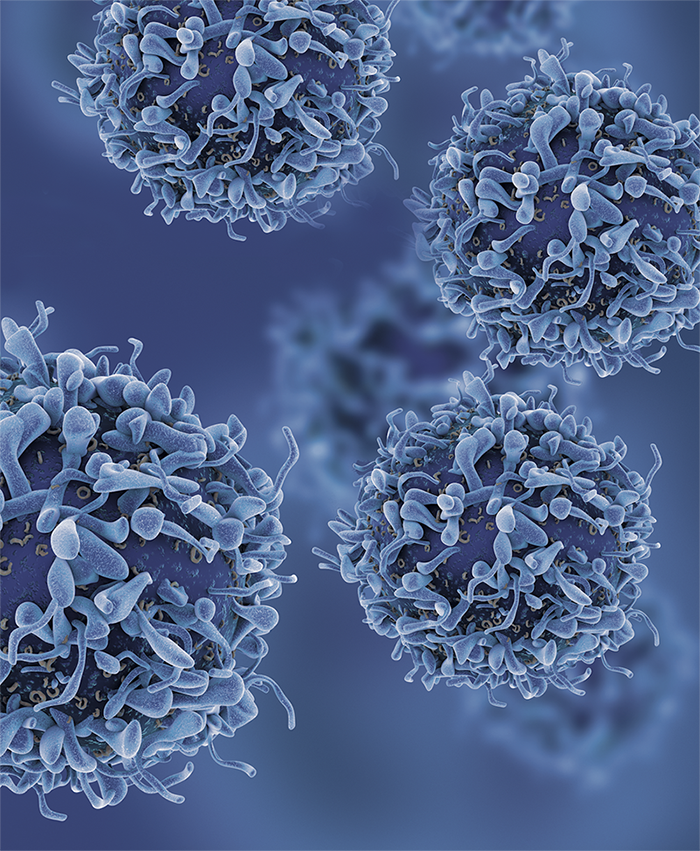 Breast cancer cells