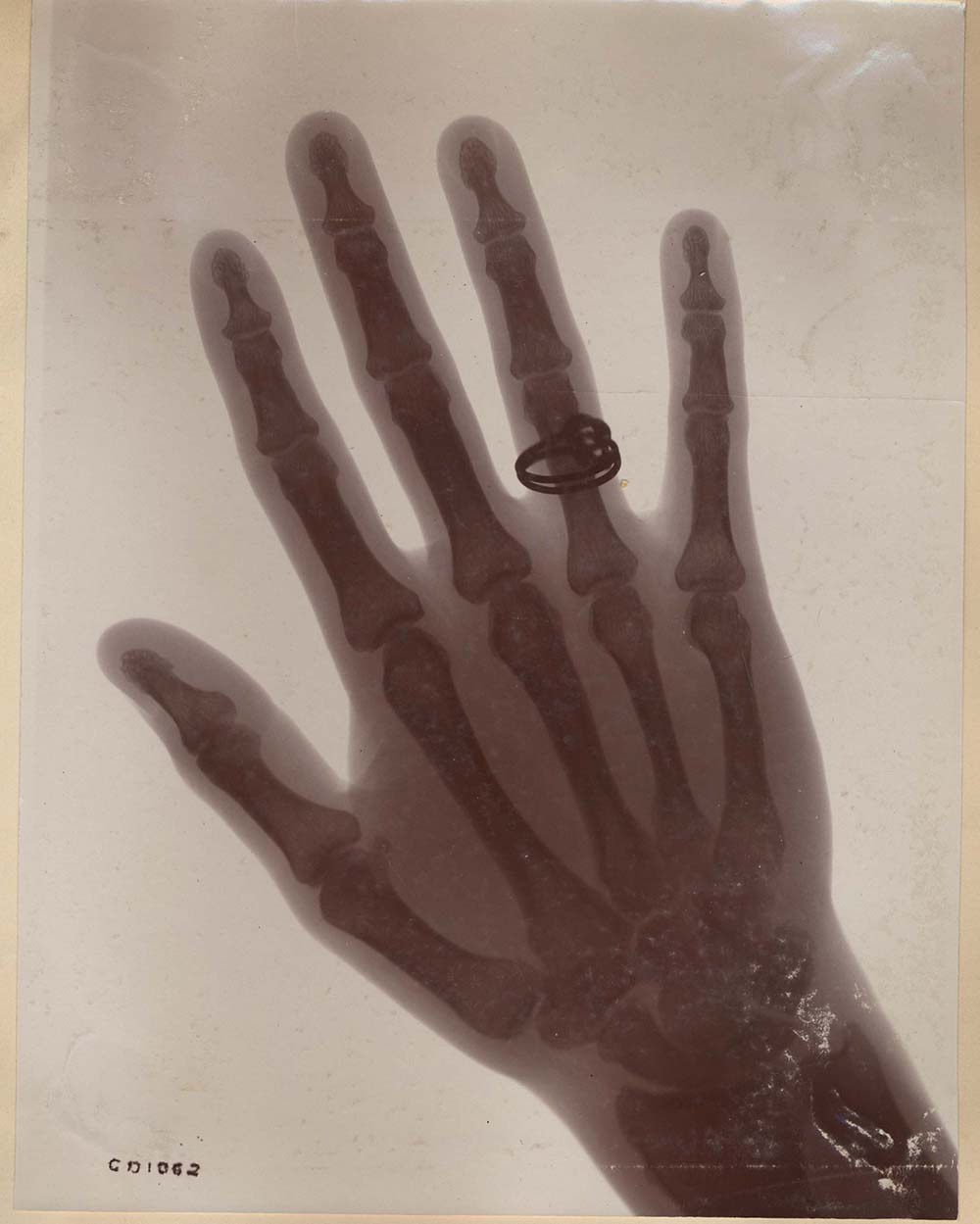 Xray of hand