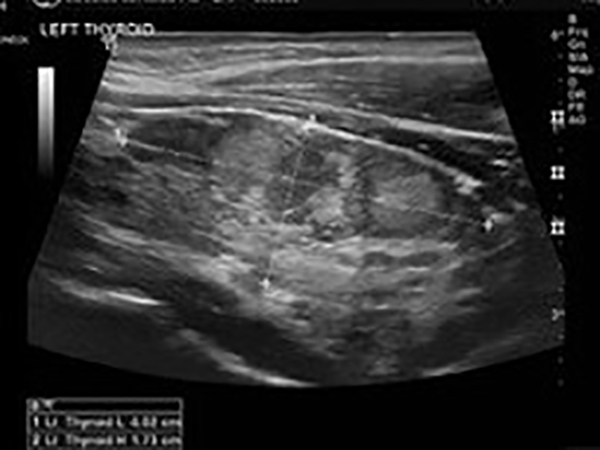 Vscan image