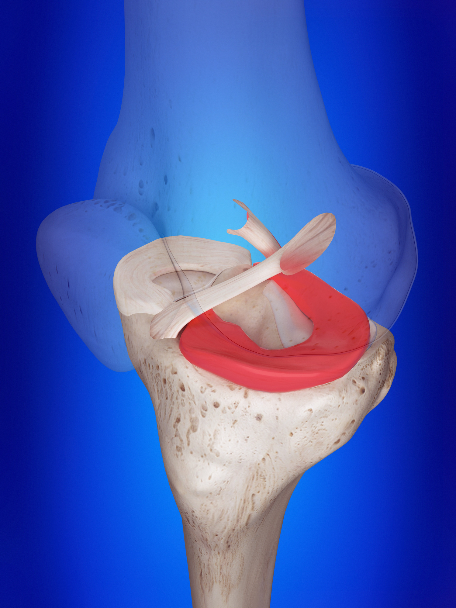 Meniscus Getty Images