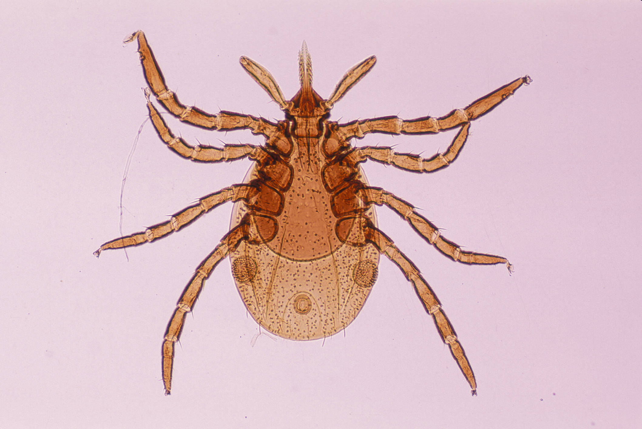 Ixodes dammini
