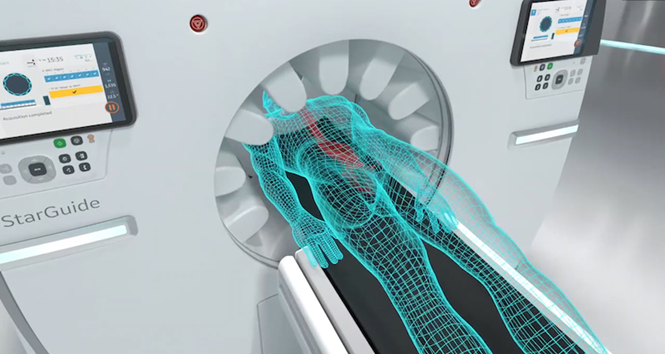 Há» thá»ng StarGuide SPECT/CT. Nguá»n áº£nh: GE HealthCare.
