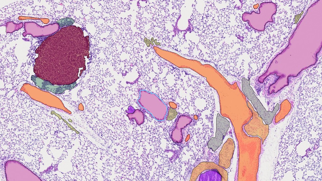 cytomine pathology