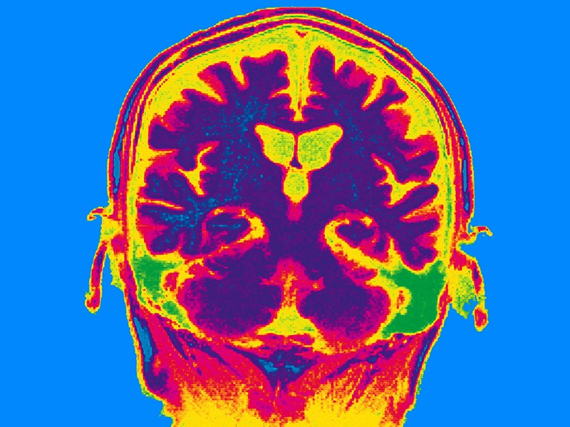 BU brain