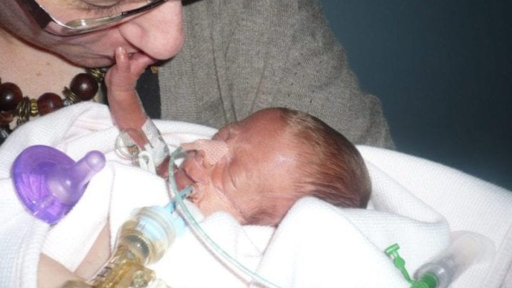 16 Hafta Erken Doğan Grace, Şimdi Dokuz Yaşında!