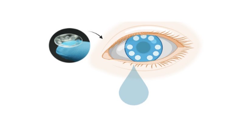 smart contacts