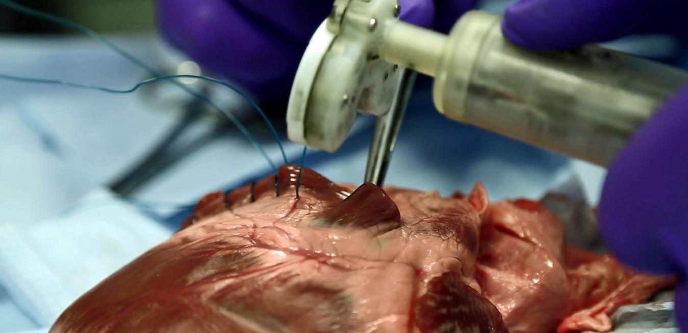 Learning By Heart 3d Printing Could Help Save Lives One Day Ge News