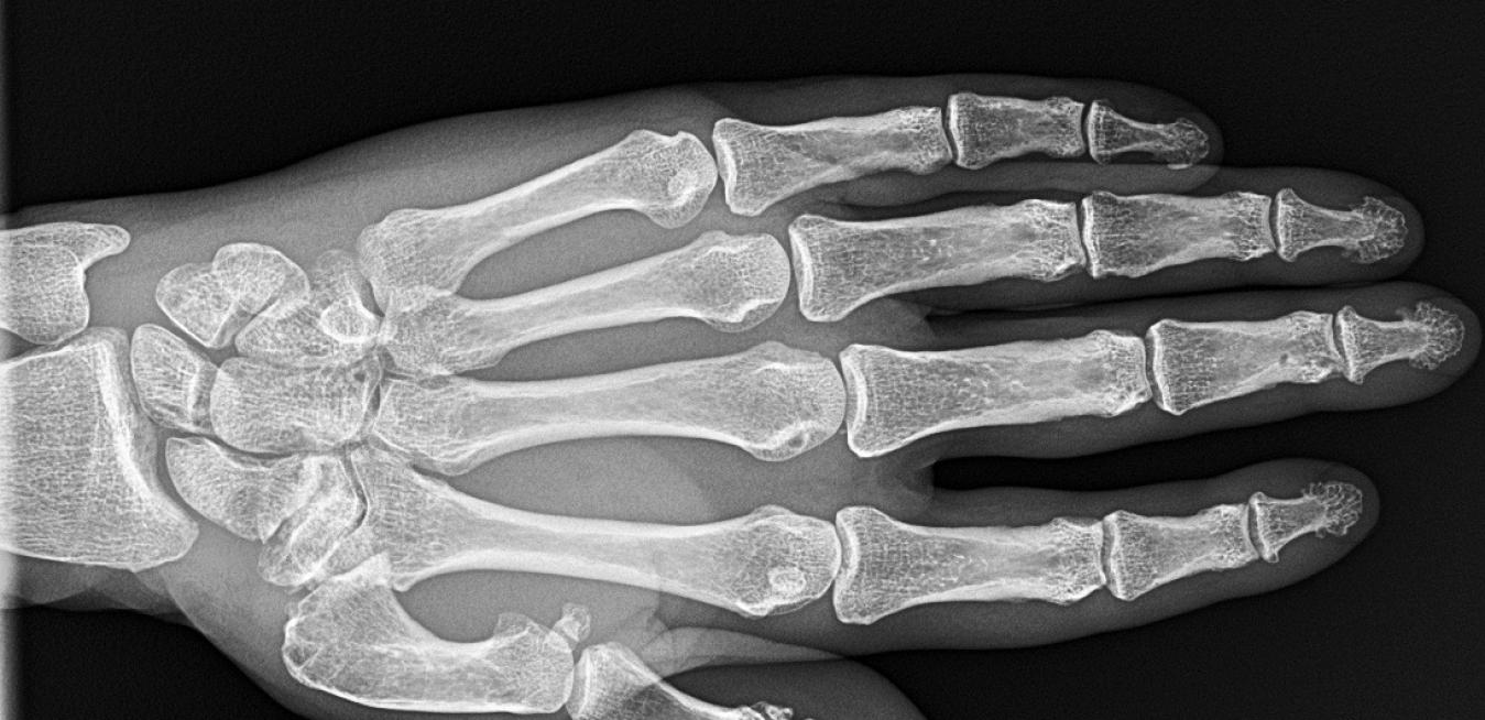 Data Vision This X Ray App Could Help Hospitals Cut Costs Ge News Data Vision This X Ray App Could Help Hospitals Cut Costs Ge News