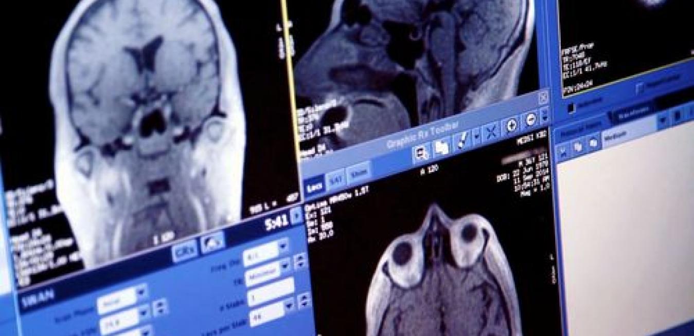 аппарат мрт внутри. магнитный томограф магнит. звуки издающие мрт. звуки издающие мрт. мрт звуки внутри аппарата.