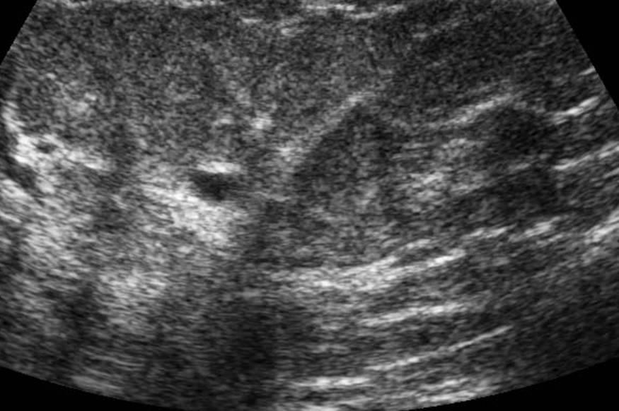 Ultrasound Imaging image